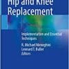 Outpatient Hip and Knee Replacement: Implementation and Essential Techniques (EPUB)