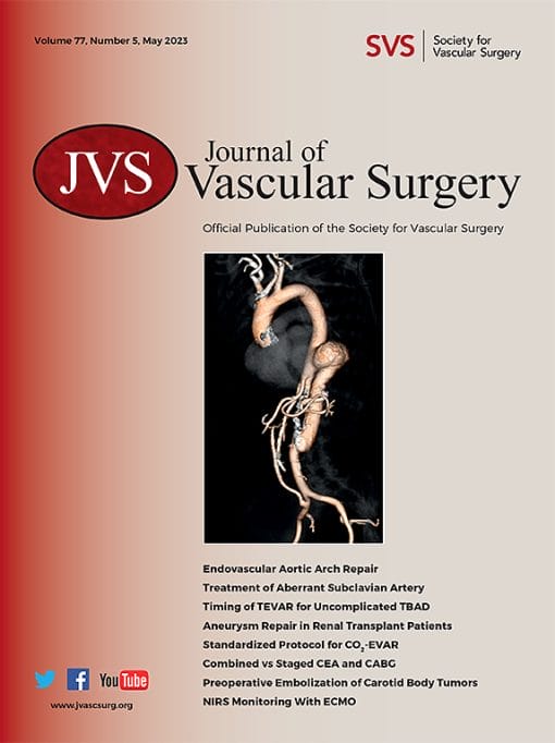 Journal of Vascular Surgery: Volume 77 (Issue 1 to Issue 6) 2023 PDF