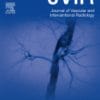 Journal of Vascular and Interventional Radiology: Volume 33 (Issue 1 to Issue 12) 2022 PDF