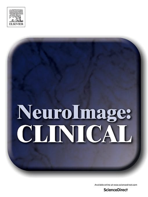 NeuroImage: Clinical – Volume 29 to Volume 32 2021 PDF
