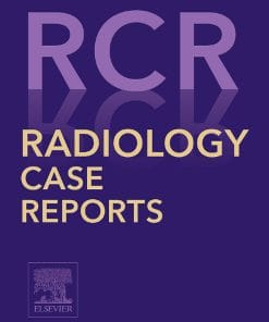 Radiology Case Reports: Volume 15 (Issue 1 to Issue 12) 2020 PDF