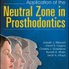 Application of the Neutral Zone in Prosthodontics (PDF)