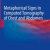 Metaphorical Signs in Computed Tomography of Chest and Abdomen, 2nd Edition (PDF)