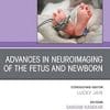 Advances in Neuroimaging of the Fetus and Newborn, An Issue of Clinics in Perinatology (Volume 49-3) (The Clinics: Internal Medicine, Volume 49-3) (PDF)
