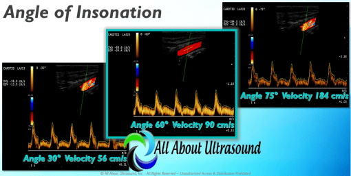 Mastering Doppler Principles and Hemodynamics- AllAboutUltrasound (HTML)