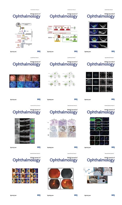 British Journal of Ophthalmology 2022 Full Archives (PDF)