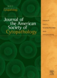 Journal of the American Society of Cytopathology: Volume 9 (Issue 1 to Issue 6) 2020 PDF