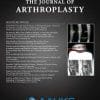The Journal of Arthroplasty: Volume 38 (Issue 1 to Issue 12) 2023 PDF