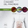 Enfermedades comunes del pancreas