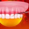 Ohi-Non-surgical periodontal therapy and minimally invasive protocols