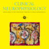 Clinical Neurophysiology: Volume 145 to Volume 156 2023 PDF