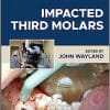 Impacted Third Molars, 2nd Edition (PDF)