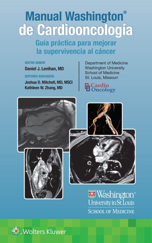 Manual Washington de Cardiooncología Guía práctica para mejorar la supervivencia al cáncer (EPUB)