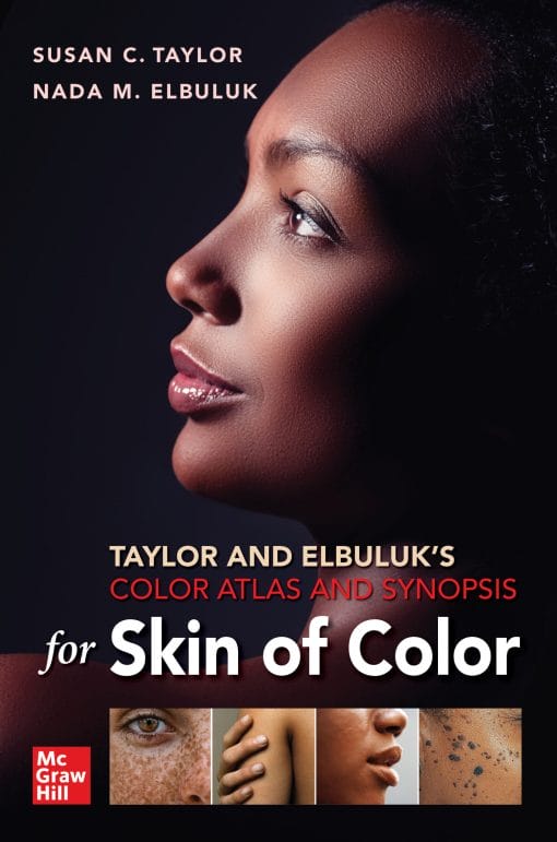 Taylor and Elbuluk’s Color Atlas and Synopsis for Skin of Color (PDF)