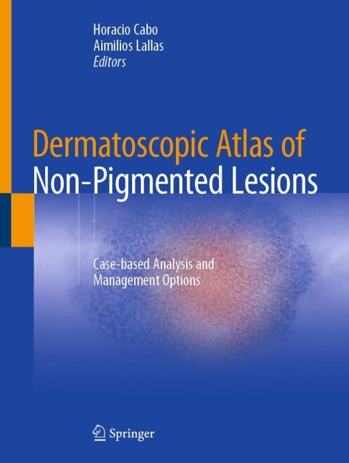 Dermatoscopic Atlas of Non-Pigmented Lesions (PDF)