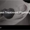 SpearProsthetically Driven Treatment Planning for Implants