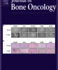 Journal of Bone Oncology: Volume 20 to Volume 25 2020 PDF
