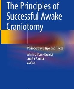 The Principles of Successful Awake Craniotomy (PDF)