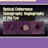 Optical Coherence Tomography Angiography of the Eye (EPUB)