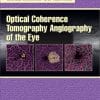 Optical Coherence Tomography Angiography of the Eye (PDF)