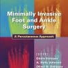 Minimally Invasive Foot and Ankle Surgery: A Percutaneous Approach (ePub+Converted PDF)