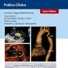 Cirurgia A Laser De Femtossegundo Em Oftalmologia (Portuguese Edition) (PDF)