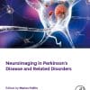 Neuroinflammation in Vascular Dementia (EPUB)