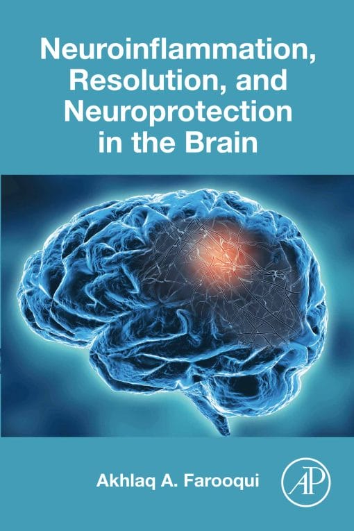 Neuroinflammation, Resolution, and Neuroprotection in the Brain (EPUB)