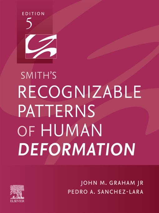 Smith’s Recognizable Patterns Of Human Deformation, 5th Edition (EPUB)
