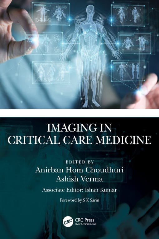Imaging In Critical Care Medicine (EPUB)