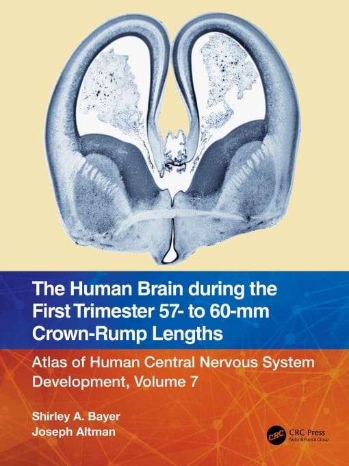 The Human Brain During The First Trimester 57- To 60-Mm Crown-Rump Lengths: Atlas Of Human Central Nervous System Development, Volume 7 (EPUB)