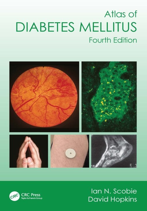 Atlas Of Diabetes Mellitus, 4th Edition (EPUB)