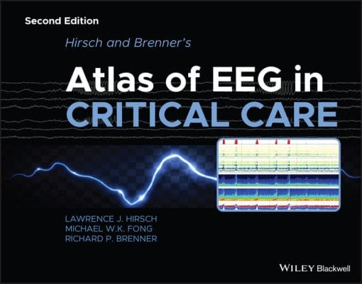 Hirsch And Brenner’s Atlas Of EEG In Critical Care, 2nd Edition (EPUB)