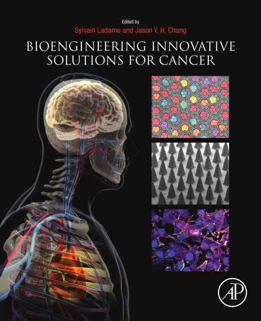 Bioengineering Innovative Solutions For Cancer (PDF)