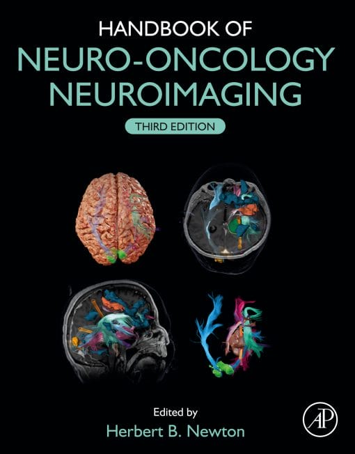 Handbook Of Neuro-Oncology Neuroimaging, 3rd Edition (EPUB)