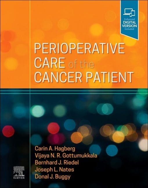 Perioperative Care Of The Cancer Patient (EPUB)