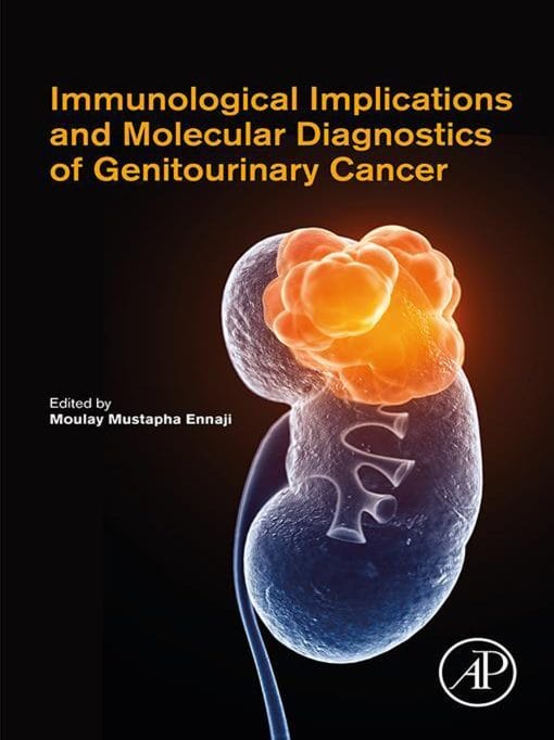 Immunological Implications And Molecular Diagnostics Of Genitourinary Cancer (EPUB)