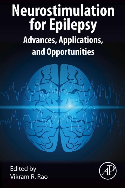 Neurostimulation For Epilepsy: Advances, Applications And Opportunities (EPUB)