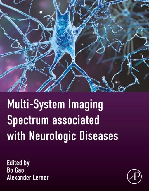 Multi-System Imaging Spectrum Associated With Neurologic Diseases (EPUB)