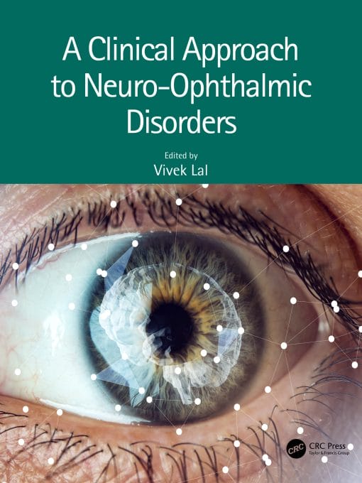 A Clinical Approach To Neuro-Ophthalmic Disorders (EPUB)