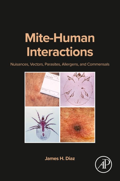 Mite-Human Interactions: Nuisances, Vectors, Parasites, Allergens, And Commensals (EPUB)