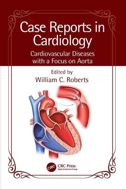 Case Reports In Cardiology: Cardiovascular Diseases With A Focus On Aorta (EPUB)