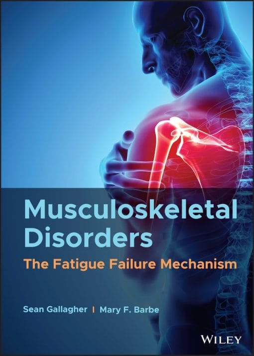 Musculoskeletal Disorders: The Fatigue Failure Mechanism (EPUB)