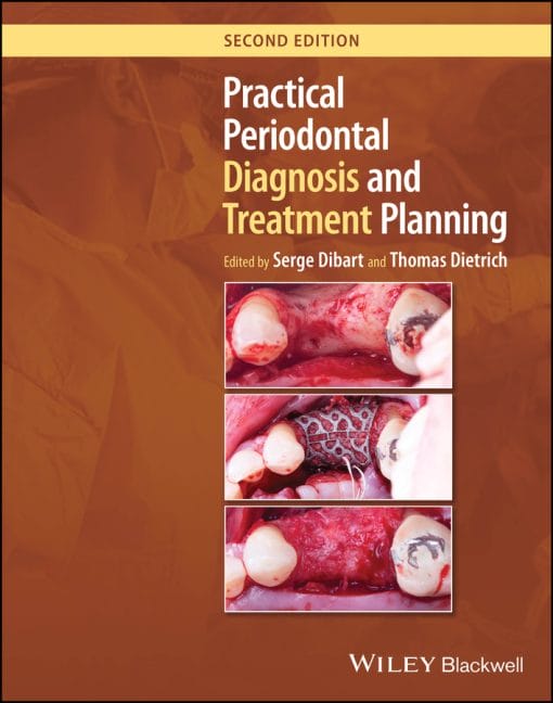Practical Periodontal Diagnosis And Treatment Planning, 2nd Edition (EPUB)