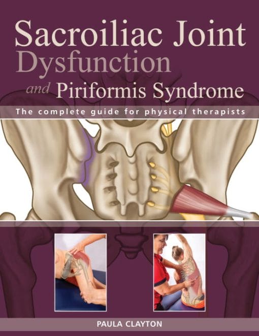 Sacroiliac Joint Dysfunction And Piriformis Syndrome: The Complete Guide For Physical Therapists (EPUB)