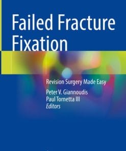 Fragility Fracture and Orthogeriatric NursingHolistic Care and Management of the Fragility Fracture and Orthogeriatric Patient