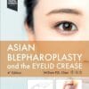 Asian Blepharoplasty And The Eyelid Crease, 4th Edition (PDF)