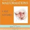 Cloacal Malformations: Case Studies (Pediatric Colorectal Surgery) (PDF)