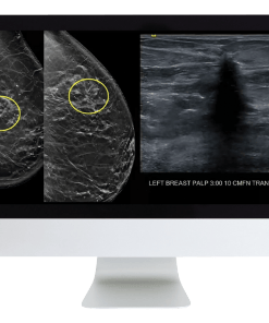 Case Review of Breast Imaging