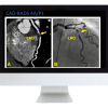 Case Review of Cardiopulmonary Imaging